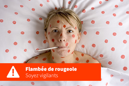 240205_flambee_rougeole.jpg